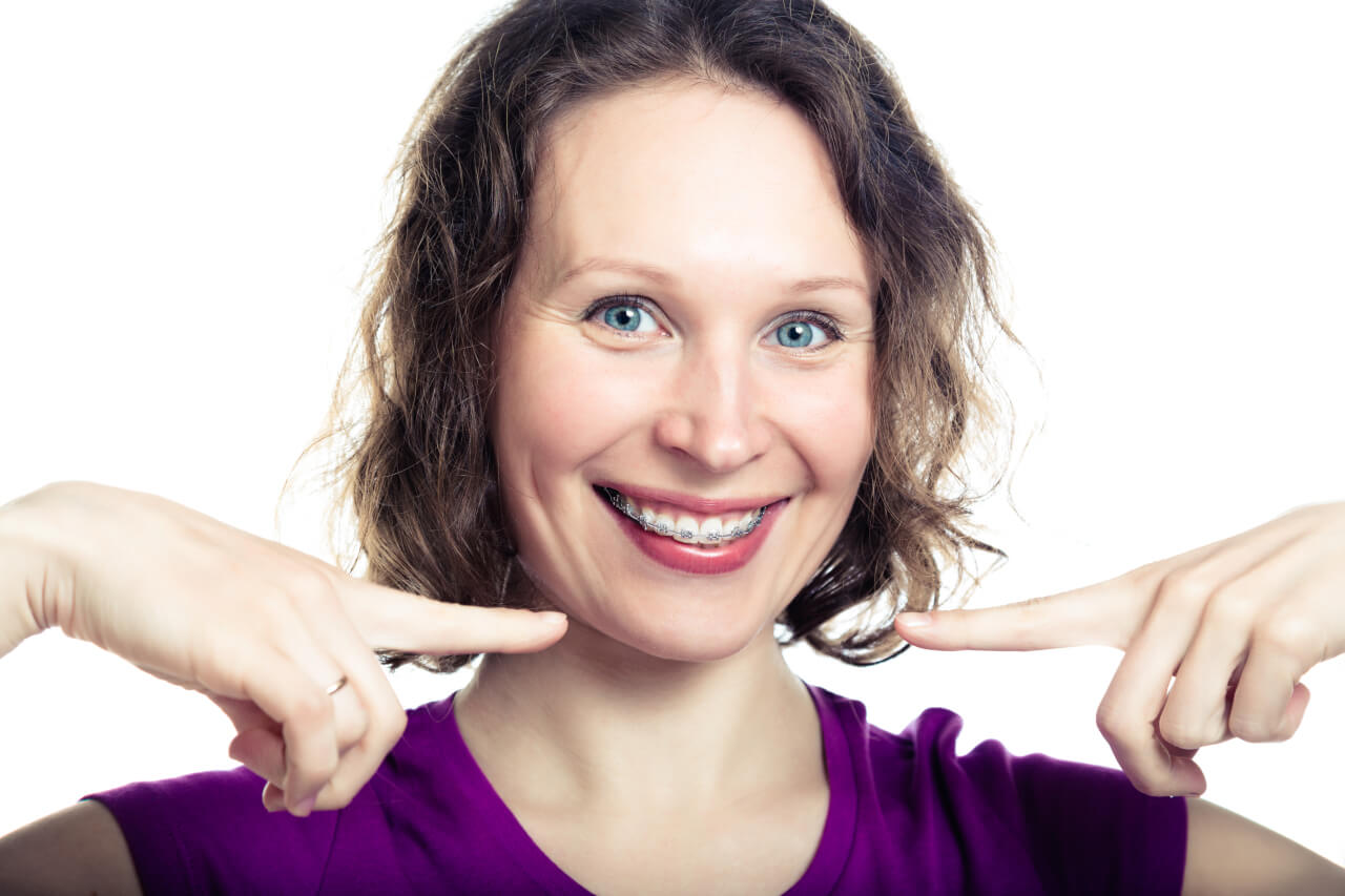 Adult Braces