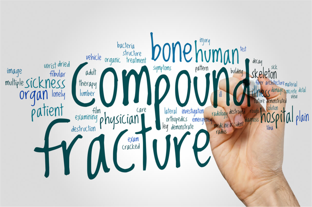 compound fracture first aid