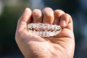 diy invisalign