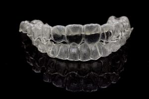 diy invisalign